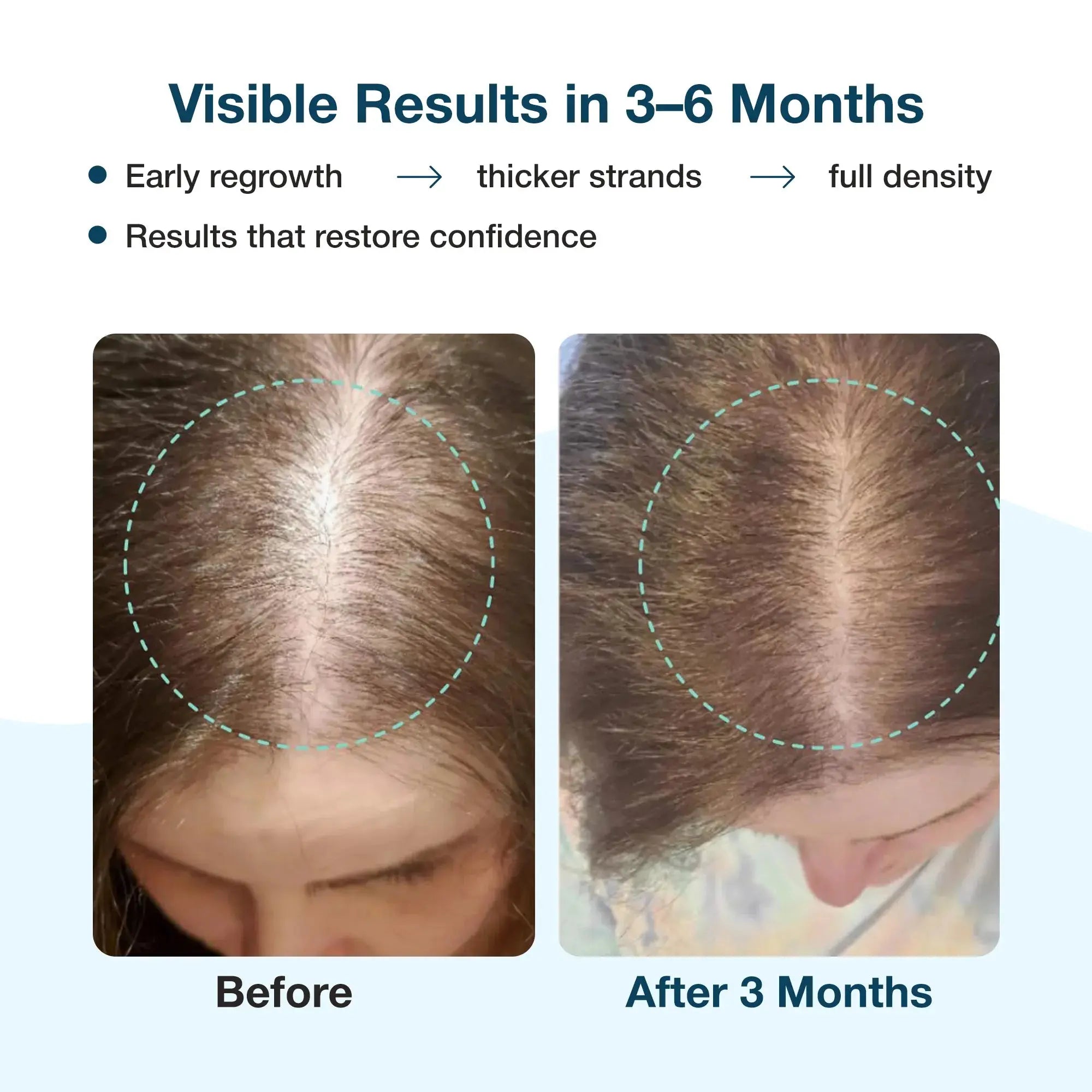 Before & after photos show hair regrowth and increased density after 3 months, promising visible results in 3-6 months.