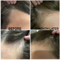 postpartum hair loss before and after