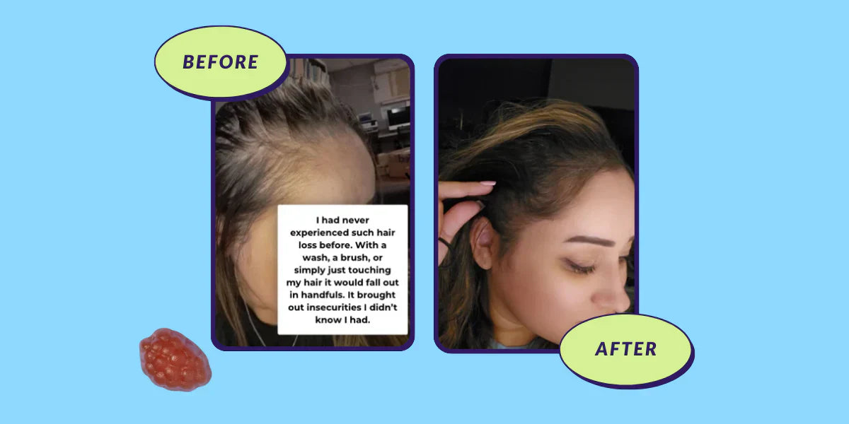 Ashleys 7-Week Postpartum Hair Growth