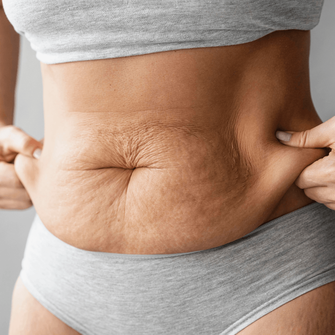 Sagging Skin after Baby: 3 Things I Use that Actually Improve my Skin's Appearance - Baby Blues