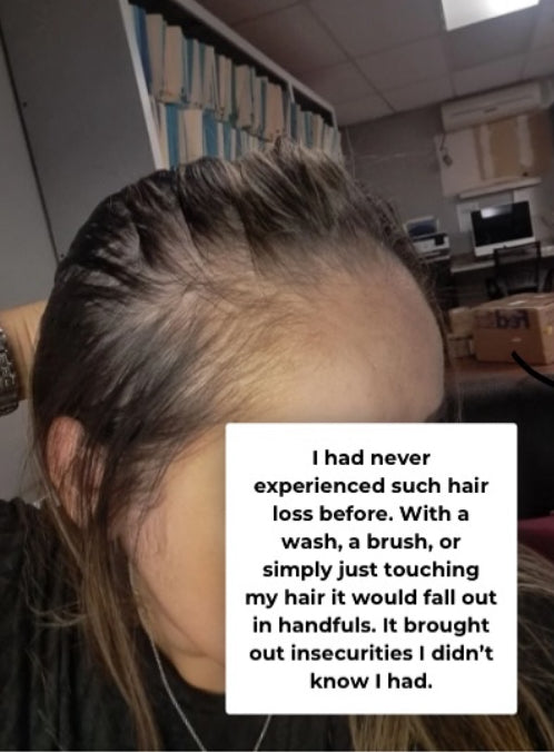 Ashley's 7-Week Postpartum Hair Growth Story