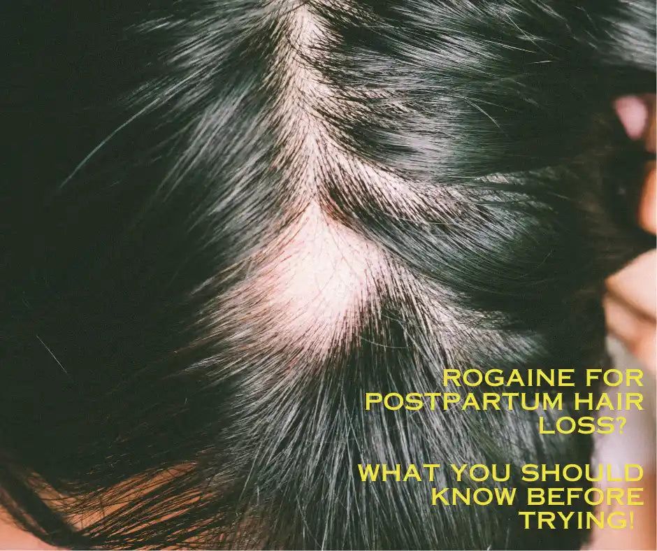Rogaine for postpartum hair loss