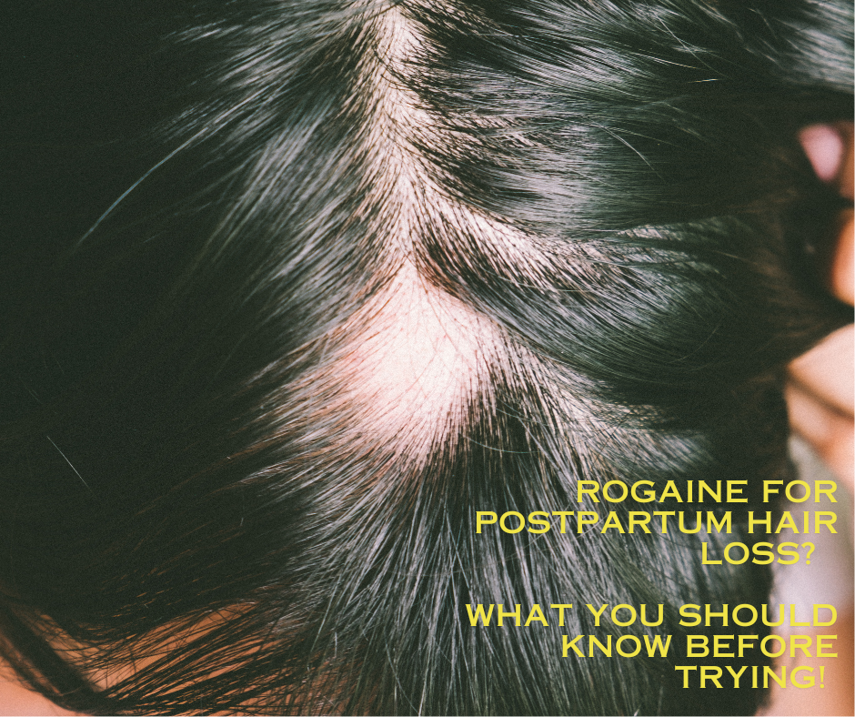 Rogaine For Postpartum Hair Loss? What You Should Know Before Trying!