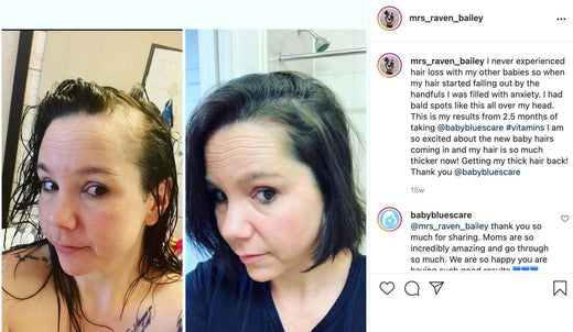 The one thing that helped my postpartum hair loss... and I tried everything. - Baby Blues