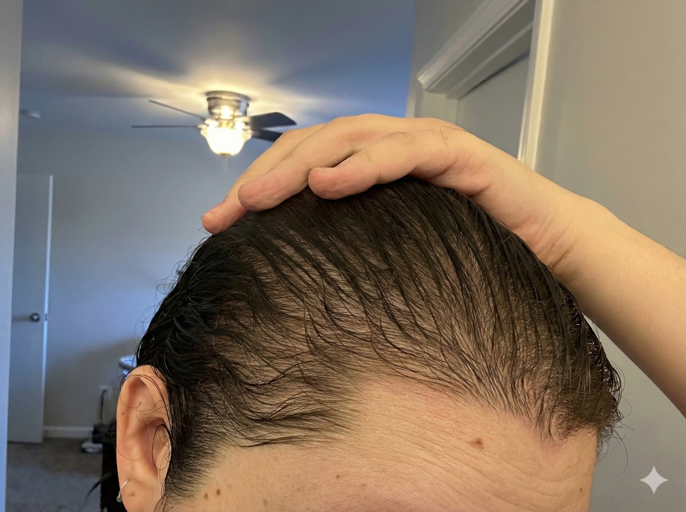 Hand lifting wet hair to reveal noticeable thinning along the scalp, highlighting postpartum hair loss.