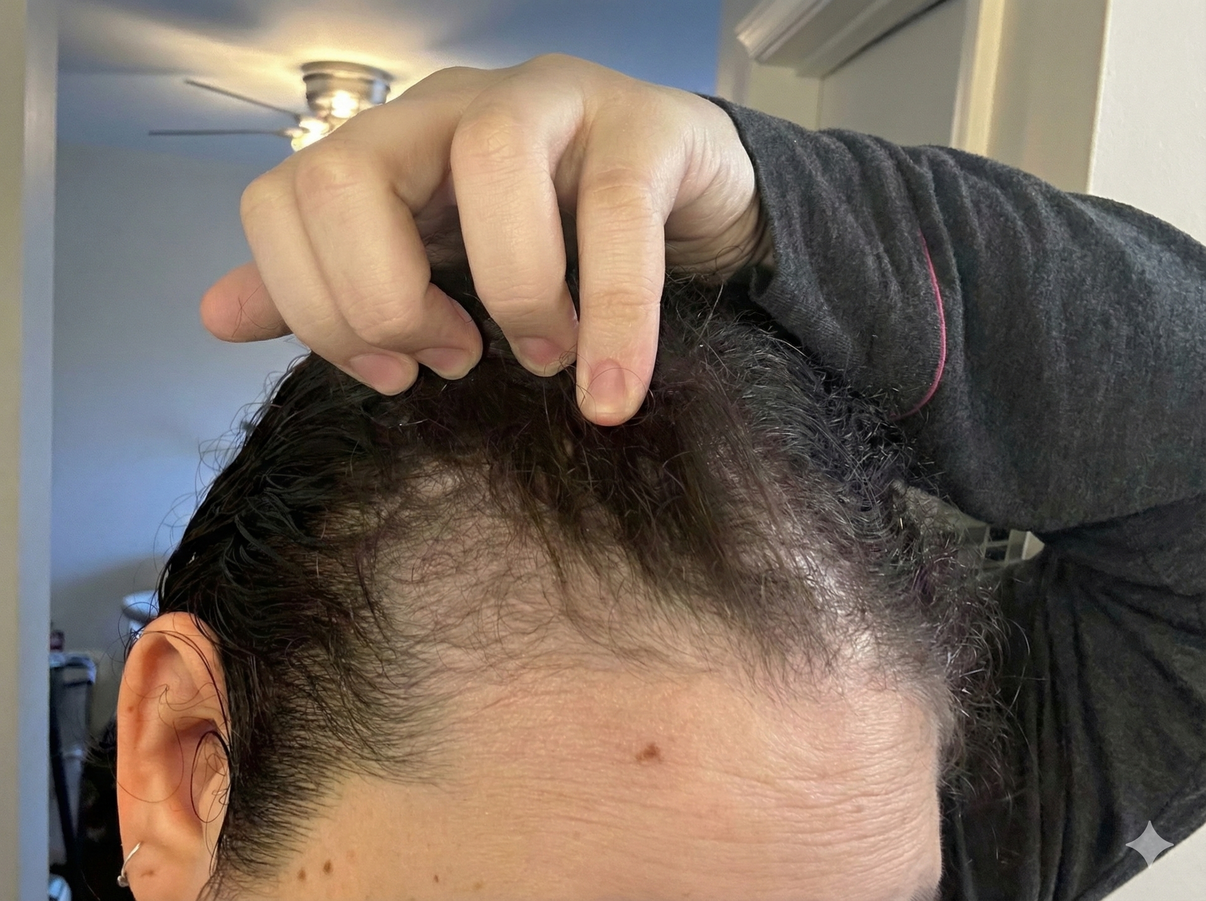 Hand parting wet hair to show thinning near the hairline, demonstrating common postpartum shedding areas.