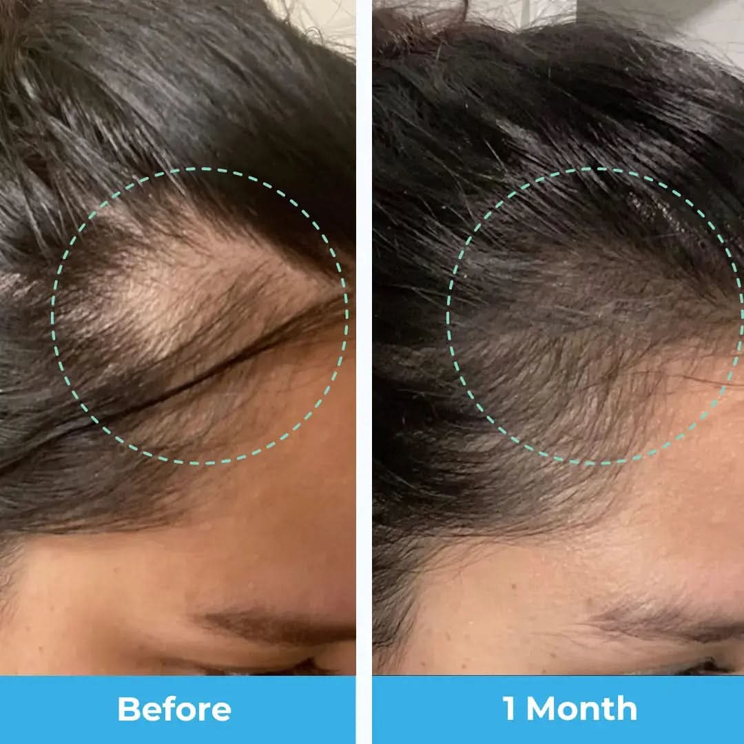 Postpartum Hair Vitamins - 3 Month Supply Baby Blues