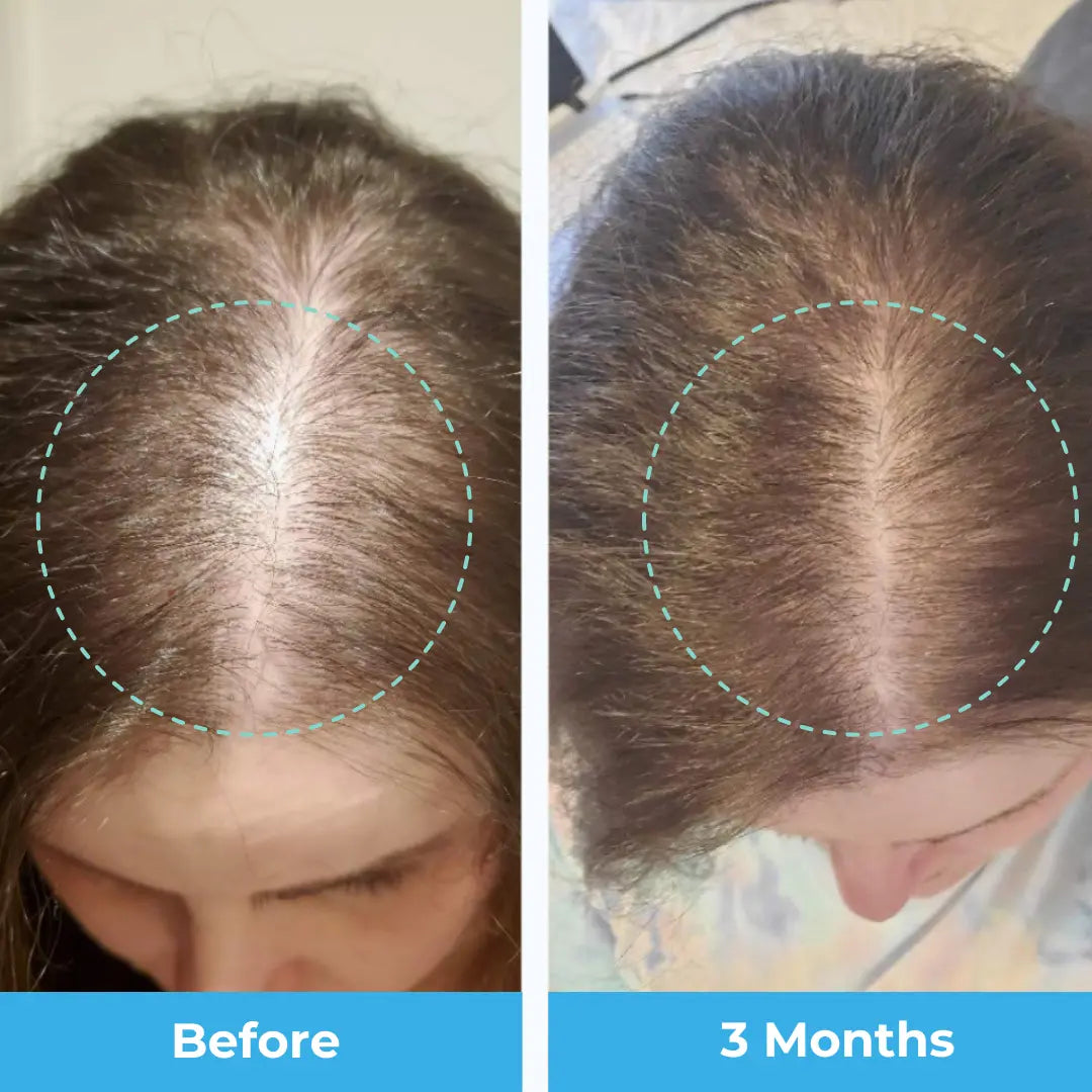 Postpartum Hair Vitamins - 3 Month Supply Baby Blues