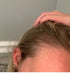 best postpartum hair loss vitamins