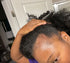 best vitamins for postpartum hair loss