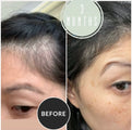 best vitamins postpartum hair loss