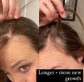 best vitamins postpartum hair loss