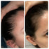hair vitamins for postpartum hair loss