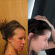 postpartum hair loss vitamins by baby blues