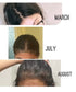 postpartum hair loss vitamins reviews