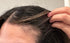 postpartum hair loss vitamins while breastfeeding