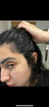 postpartum vitamins for hair loss