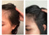 postpartum vitamins hair loss