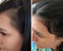 vitamins for hair loss postpartum