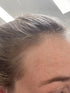 vitamins postpartum hair loss