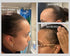 vitamins that help with postpartum hair loss