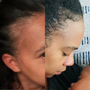 vitamins to help with postpartum hair loss