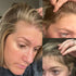 vitamins to prevent postpartum hair loss