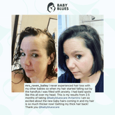 Postpartum Hair Vitamins - Baby Blues