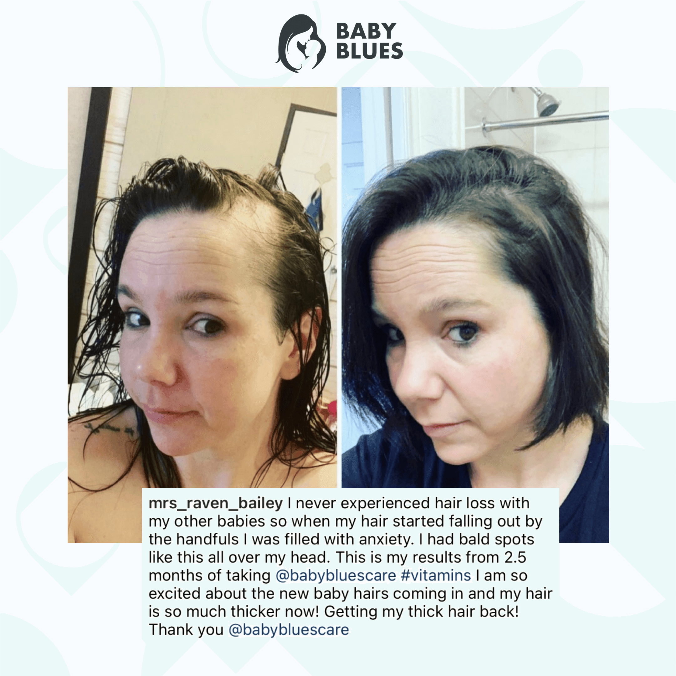 Postpartum Hair Loss Vitamins by Baby Blues